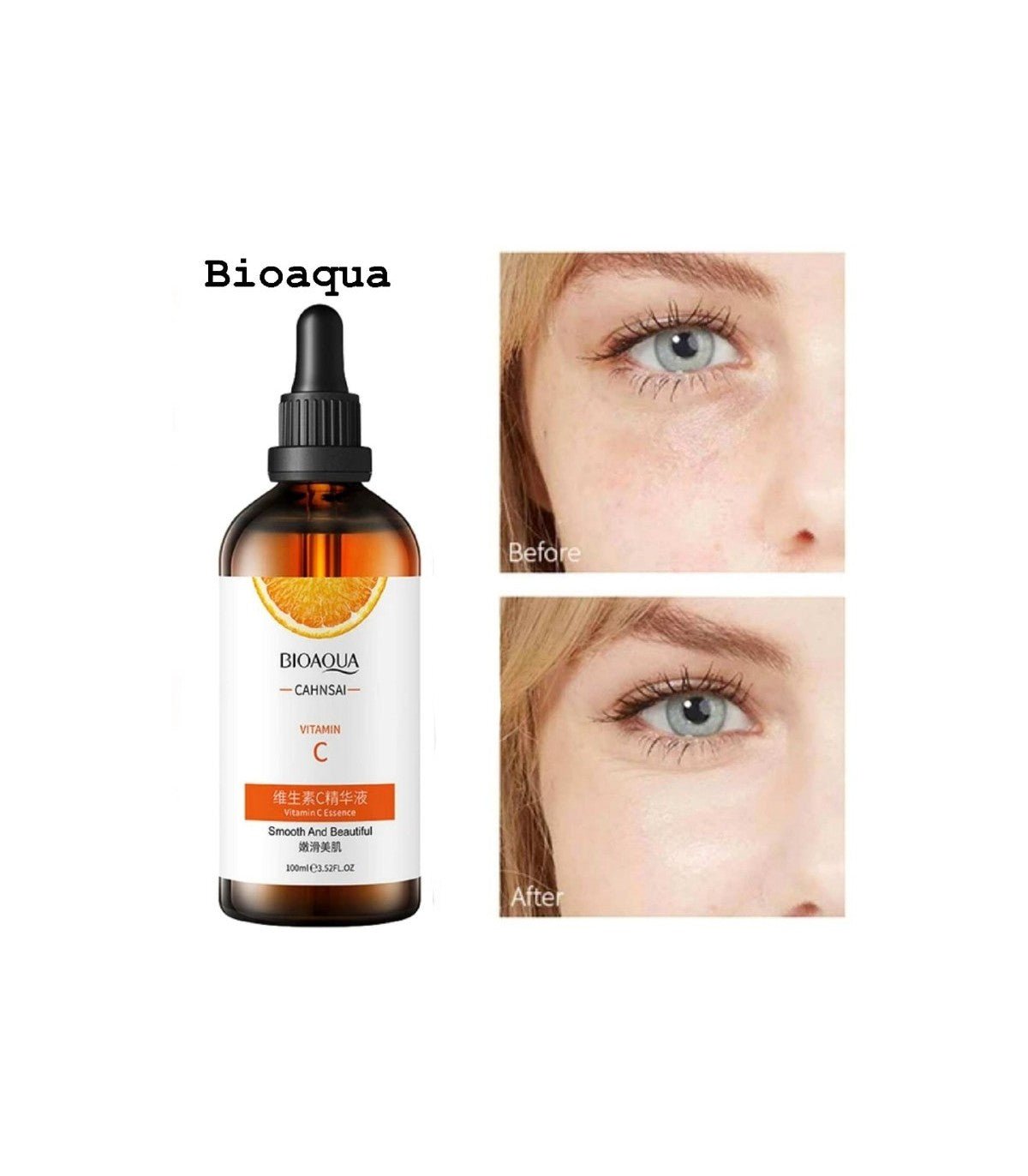 Vitamin C Serum (100ml) - Glow Brighter Every Day