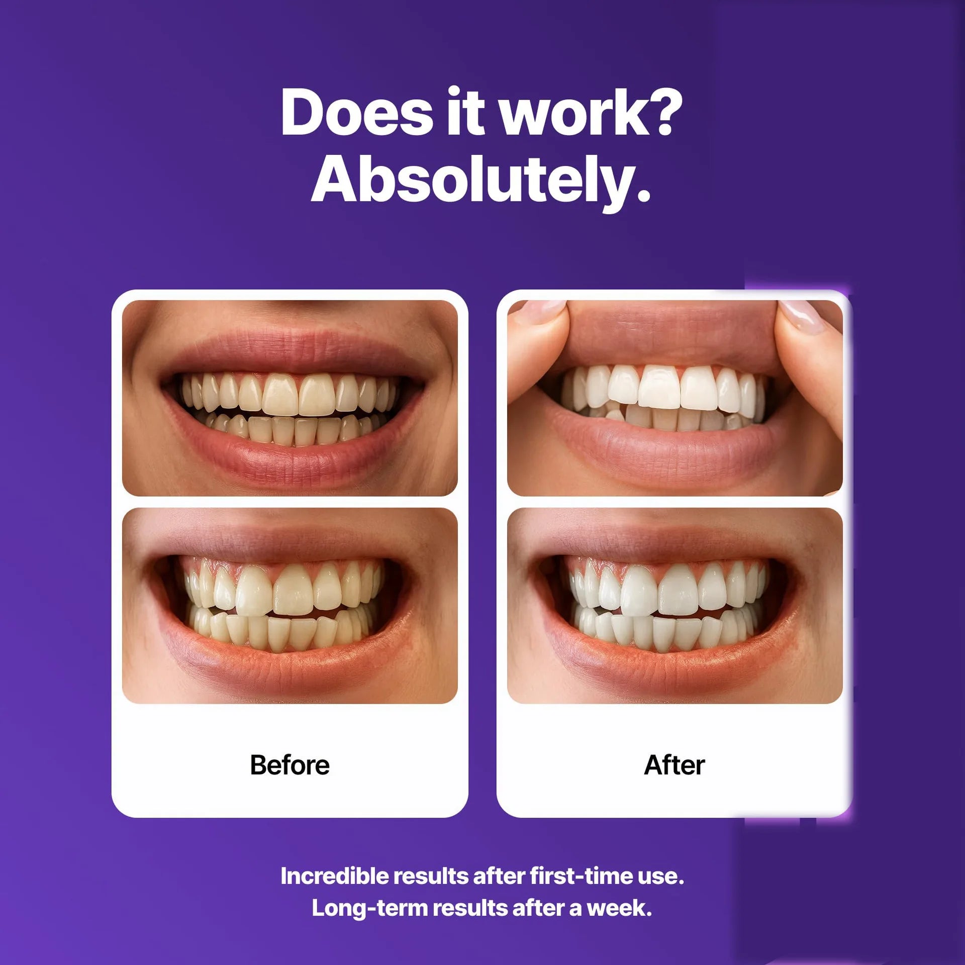 42/14 Patches Teeth Whitening Strips Gentle Formula Mint Fresh Breath Removes Coffee Tea Stains Long Lasting Stain Removal