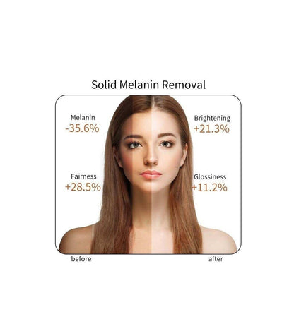 Vitamin C Serum (100ml) - Glow Brighter Every Day